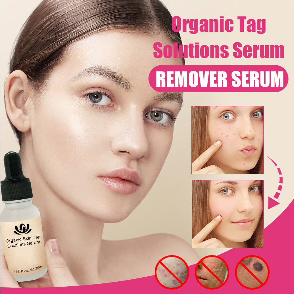 Skin Tag Remover Serum Mole Painless Face