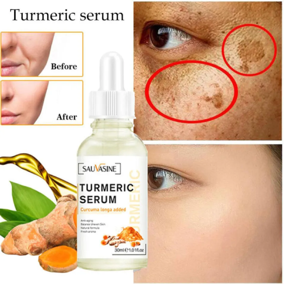 Turmeric Dark Spot Corrector Serum